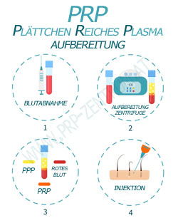 PRP Behandlung Wien Piaristengasse Derma Pen Micro Needling Axel Kllesberger orthodoc.pro